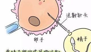 《健谈》热问丨试管婴儿顺利率是多少？与自然怀胎孩子有无差别？