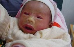 温州地区有哪些私立的机构可以做试管技术？已生孩子宝的无创dna单子数据是负数吗？