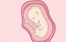 早期卵巢癌通过手术化疗能治愈吗？是什么引起卵巢癌症状