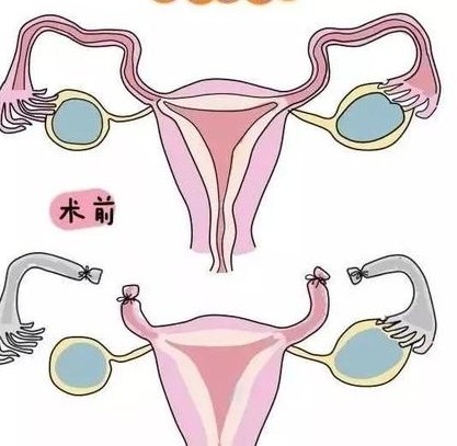 沈阳地区有哪些私立的机构可以做试管技术？输卵管堵塞积水可以做试管婴儿吗？